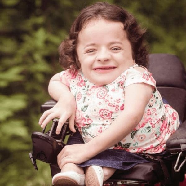 Osteogenesis Imperfecta example