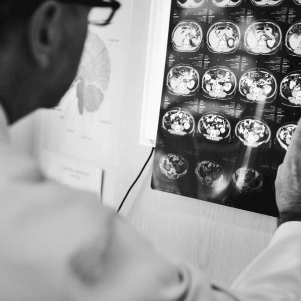 doctor inspecting brain scans