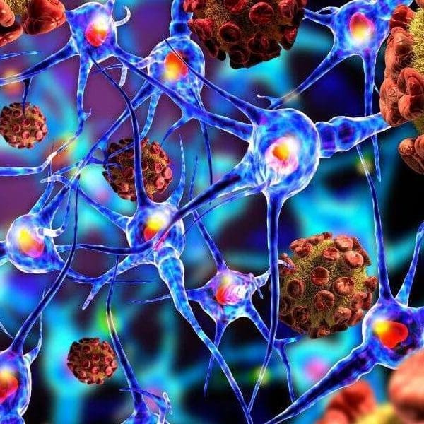 illustration of neurons with huntingdons