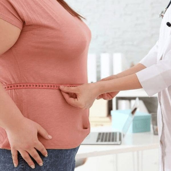 obesity and bariatric conditions